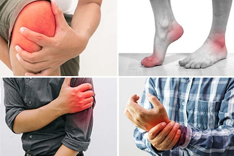 Tê bì chân tay có thể là biểu hiện của bệnh thiếu máu não